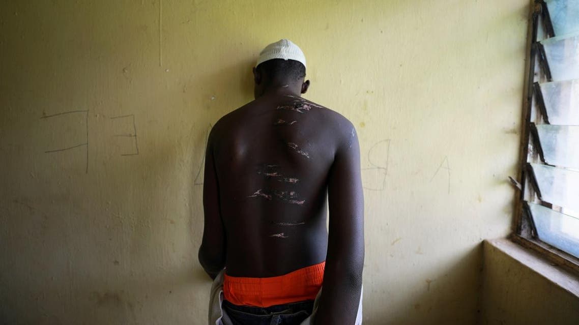 A 14 year-old-boy, one of hundreds of men and boys rescued by police from an institution purporting to be an Islamic school, reveals scars on his back at a transit camp set up to take care of the released captives in Kaduna, Nigeria September 28, 2019. (Reuters)