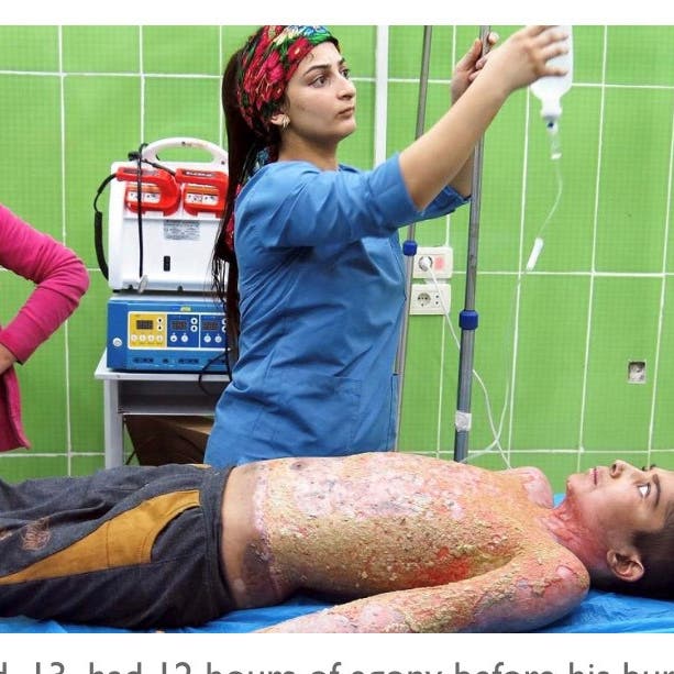 تايمز: صورة مروعة وأسلحة تركية تحرق أجساد الصغار