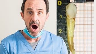 مرد کروات با بلندترین دندان رکورد گینس را شکست