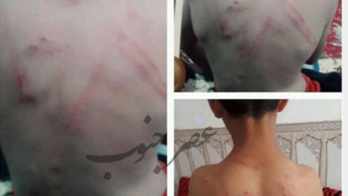 ایران... واکنشها به زخمی شدن دانشآموزی در کوت عبدالله در اثر شلاق معلماش