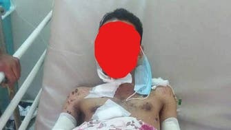 ألغام الحوثي تحصد 484 مدنياً في تعز