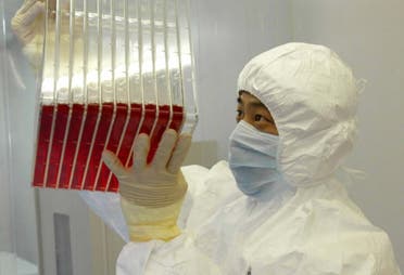 This undated photo shows a scientist observing experimental SARS vaccine living in a culture medium. (File photo: AP)