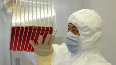 This undated photo shows a scientist observing experimental SARS vaccine living in a culture medium. (File photo: AP)