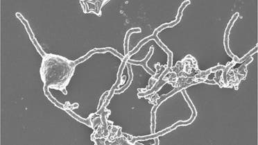 A scanning electron microscopy image of the single-celled organism Prometheoarchaeum syntrophicum strain MK-D1 showing the cell with tentacle-like branching protrusions is seen in this image released at the Japan Agency for Marine-Earth Science and Technology (JAMSTEC) in Yokosuka, Japan on January 15, 2020. Hiroyuki Imachi, Masaru K. Nobu and JAMSTEC/Handout via REUTERS NO RESALES. NO ARCHIVES. THIS IMAGE HAS BEEN SUPPLIED BY A THIRD PARTY.