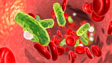 Sepsis, bacteria in blood stock photo
