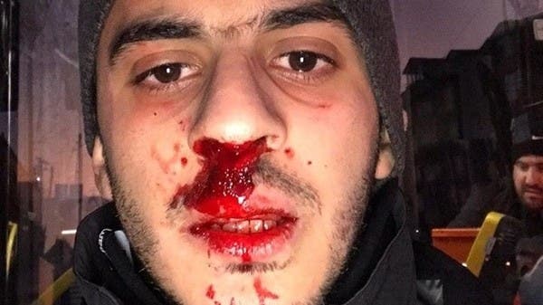 شاب مصري يتعرض للضرب في تركيا.. بسبب لغته العربية
