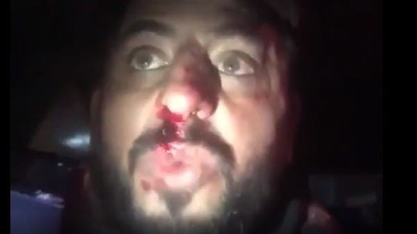 متظاهر عراقي: "شوفوا القبعات الزرق كسروا خشمي وطعنوني"
