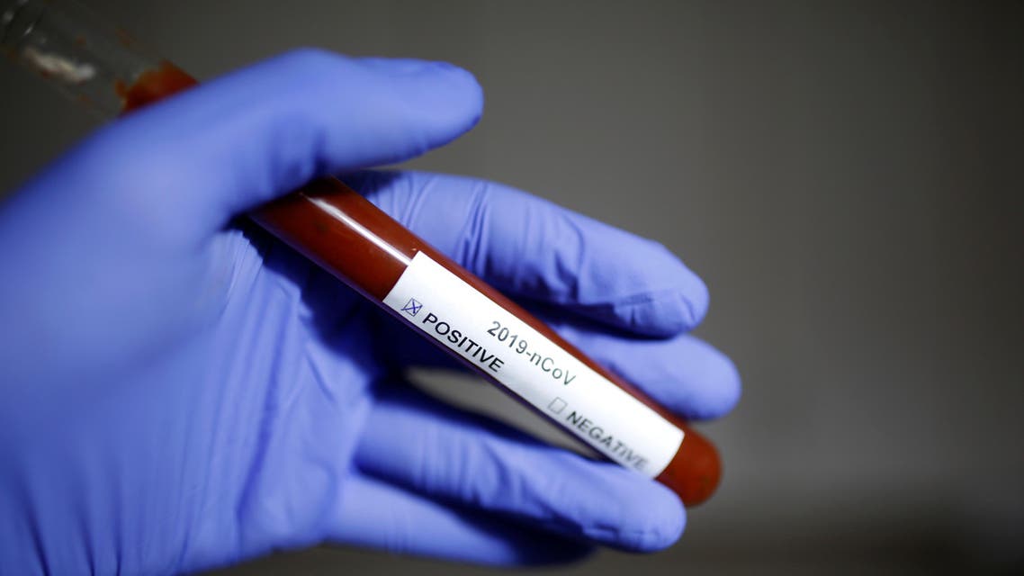 Test tube with Corona virus name label is seen in this illustration taken on January 29, 2020. (Reuters)