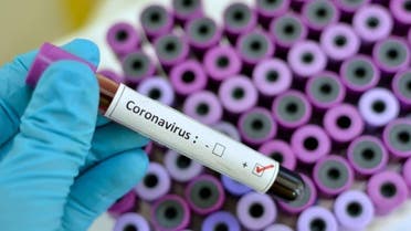With the new case registered on Monday, the number of confirmed cases of coronavirus in the UAE is now eight. (Supplied)