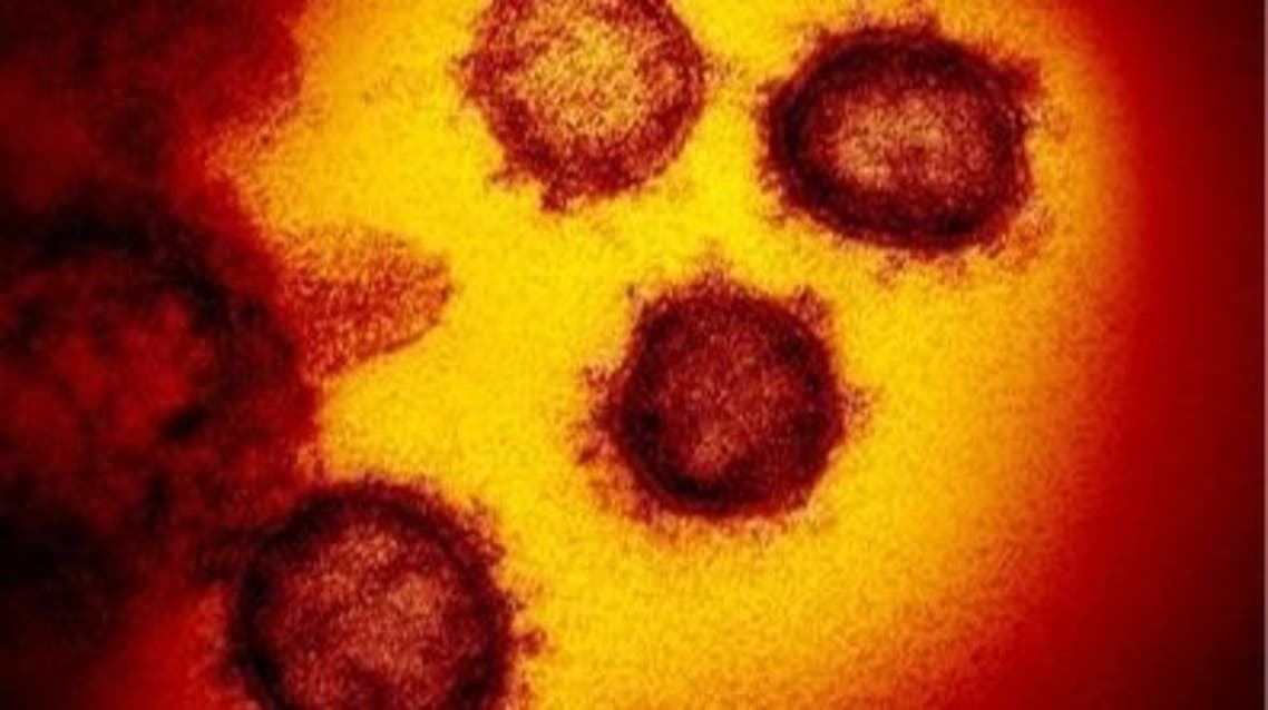 صور بالمجهر الإلكتروني من خلال المسح الضوئي لفيروس كورونا والتي نشرها باحثون أمريكيون