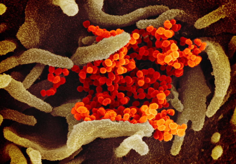 صور بالمجهر الإلكتروني من خلال المسح الضوئي لفيروس كورونا والتي نشرها باحثون أميركيون