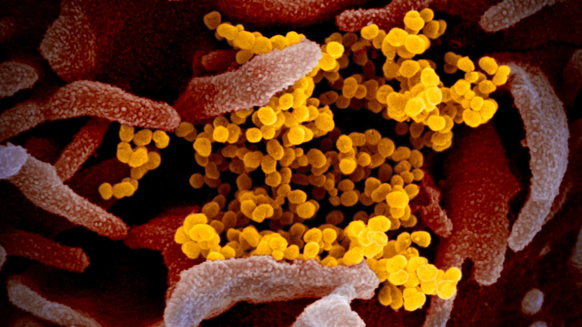 صور بالمجهر الإلكتروني من خلال المسح الضوئي لفيروس كورونا والتي نشرها باحثون أميركيون
