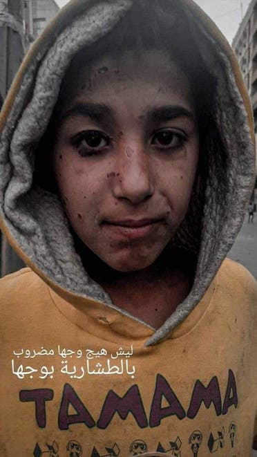 صور تداولها ناشطون عراقيون لأثر بنادق الصيد على المحتجين
