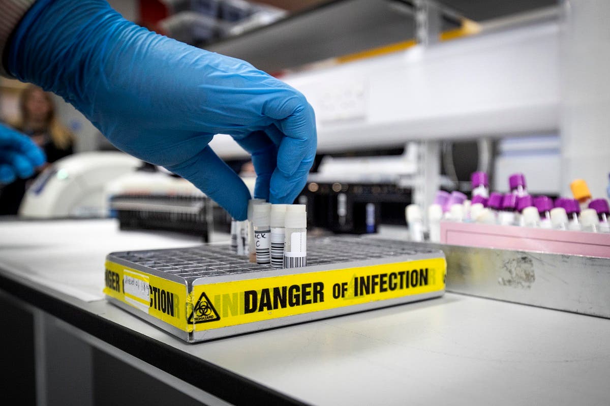 Clinical support technician Douglas Condie extracts viruses from swab samples so that the genetic structure of a virus can be analysed and identified in the coronavirus testing laboratory at Glasgow Royal Infirmary, Glasgow. (AFP)