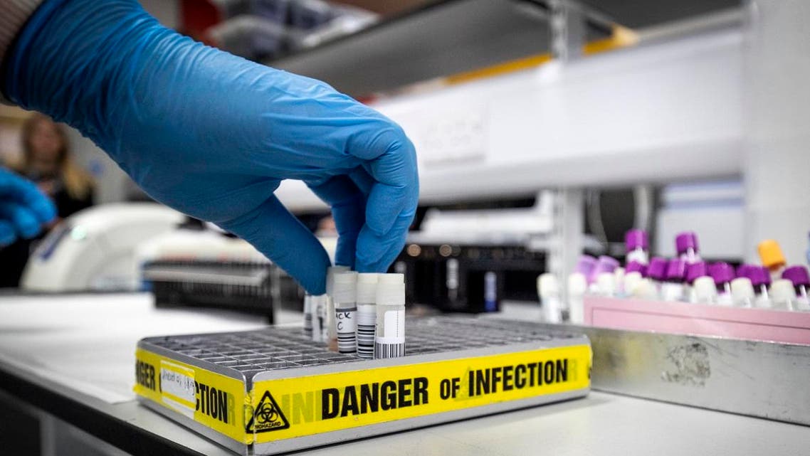 Clinical support technician Douglas Condie extracts viruses from swab samples so that the genetic structure of a virus can be analysed and identified in the coronavirus testing laboratory at Glasgow Royal Infirmary, Glasgow, on February 19, 2020. (AFP)
