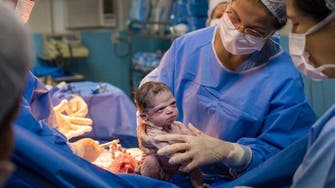 Brazilian lensman’s  photo of newborn’s angry look at doctor goes viral 