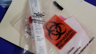 A swab to be used for testing novel coronavirus is seen in the supplies of Harborview Medical Center's home assessment team during preparations to visit the home of a person potentially exposed to novel coronavirus in Seattle, Washington, US, on February 29, 2020. (Reuters)