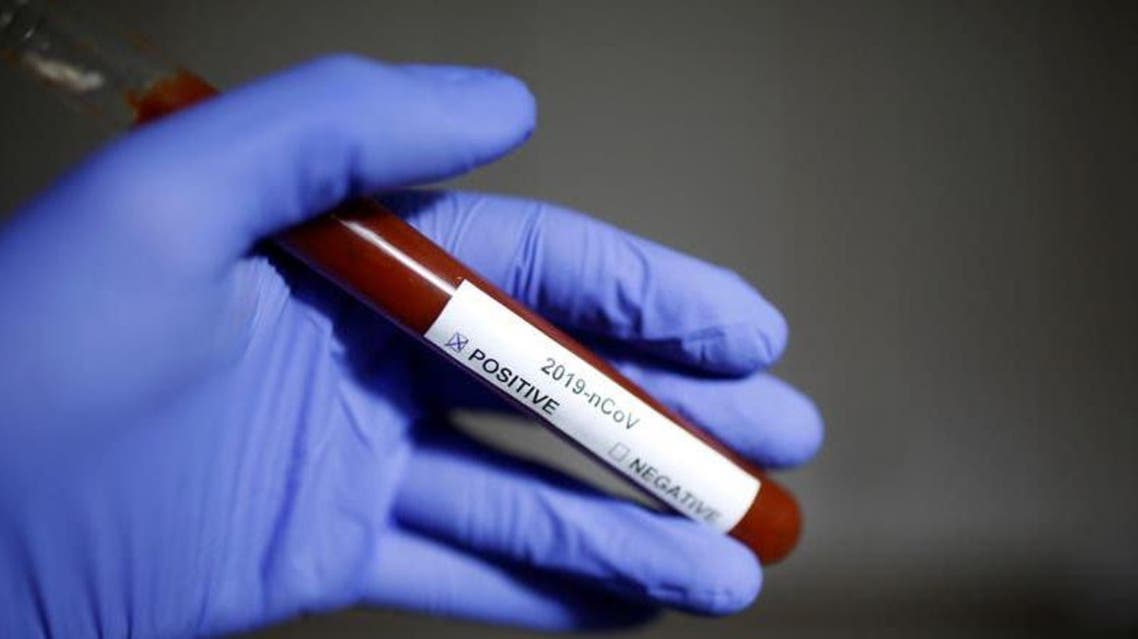 Test tube with Coronavirus name label is seen in this illustration taken on January 29, 2020. (Reuters) 