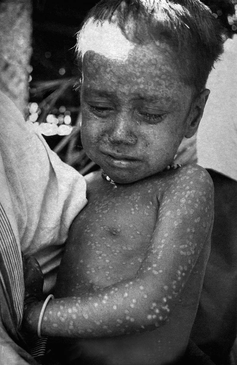 صورة للطفلة البنغالية رحيمة بانو عام 1975