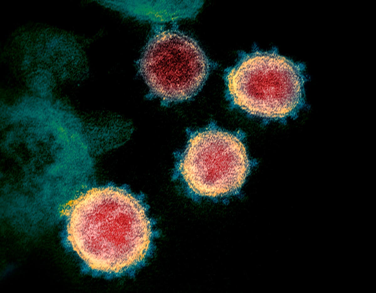 This electron microscope image made available by the US National Institutes of Health in February 2020 shows the virus that causes COVID-19. (AP)
