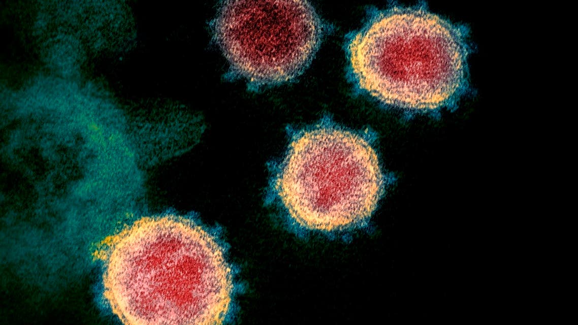 This electron microscope image made available by the US National Institutes of Health in February 2020 shows the virus that causes COVID-19. (AP)