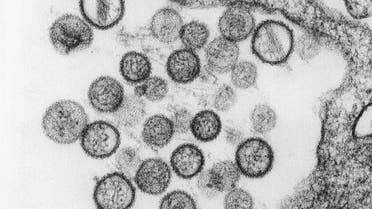 In this undated handout from the Centers for Disease Control image library, this transmission electron micrograph (TEM) reveals the ultrastructural appearance of a number of virus particles, or ?virions?, of a hantavirus known as the Sin Nombre virus (SNV). (Reuters)