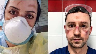 Italian nurses, doctors with bruises on their face. (Twitter)