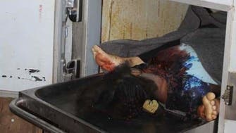 تعز میں خواتین کی جیل پر حوثیوں کے وحشیانہ حملے اور قیدیوں کے قتل عام کی تصاویر جاری