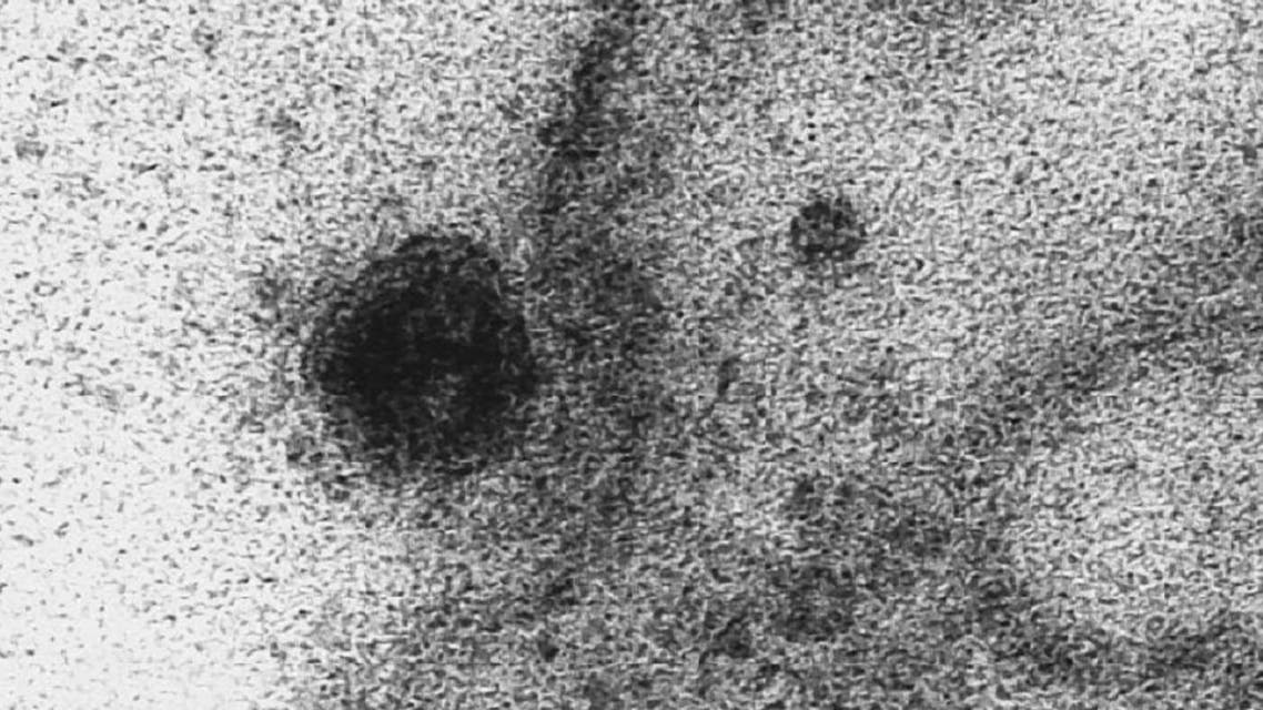الفيروس المستجد وهو يخترق غشاء الخلية