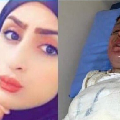 جديد ابنة النجف التي أحرقت نفسها.. وأبكت العراقيين