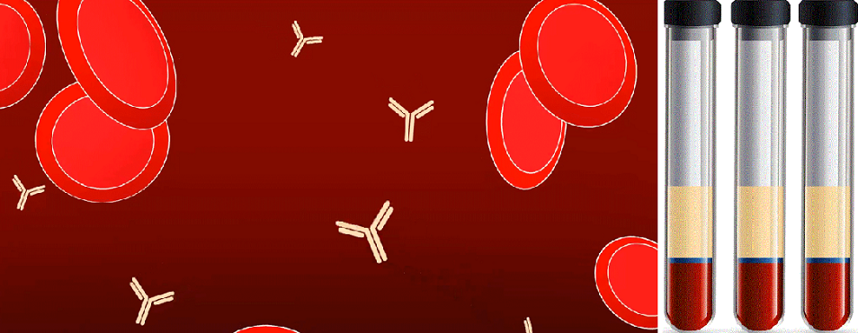 يبدأ كل شيء بالبحث عن الأجسام المضادة في بلازما دم المتعافي لمعرفة اذا لديه كميات تكفي لمكافحة الفيروس، حيث يشير القسم الأصفر في الأنبوب الى البلازما، والأزرق الى الكريات البيضاء، والأحمر لخلايا الدم 