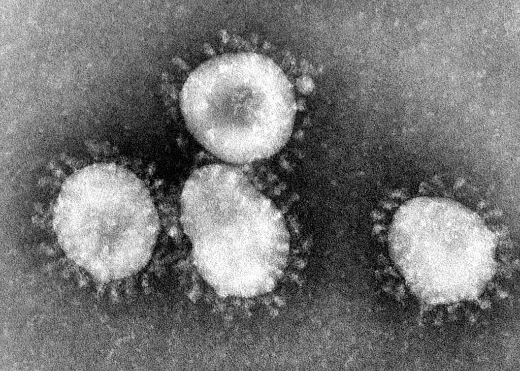 صورة مجهرية لأحد فيروسات كورونا