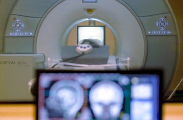 In this Nov. 26, 2014 file photo, a brain-scanning MRI machine is being used at Carnegie Mellon University in Pittsburgh. (File photo: AP)