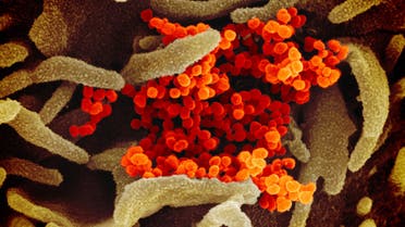 This undated electron microscope image made available by the US National Institutes of Health shows the Novel Coronavirus SARS-CoV-2, orange, emerging from the surface of cells, green, cultured in the lab. (AP)
