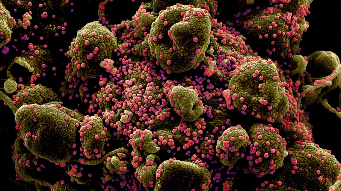 Colorized scanning electron micrograph of an apoptotic cell heavily infected with SARS-COV-2 virus particles, also known as novel coronavirus. (Reuters)