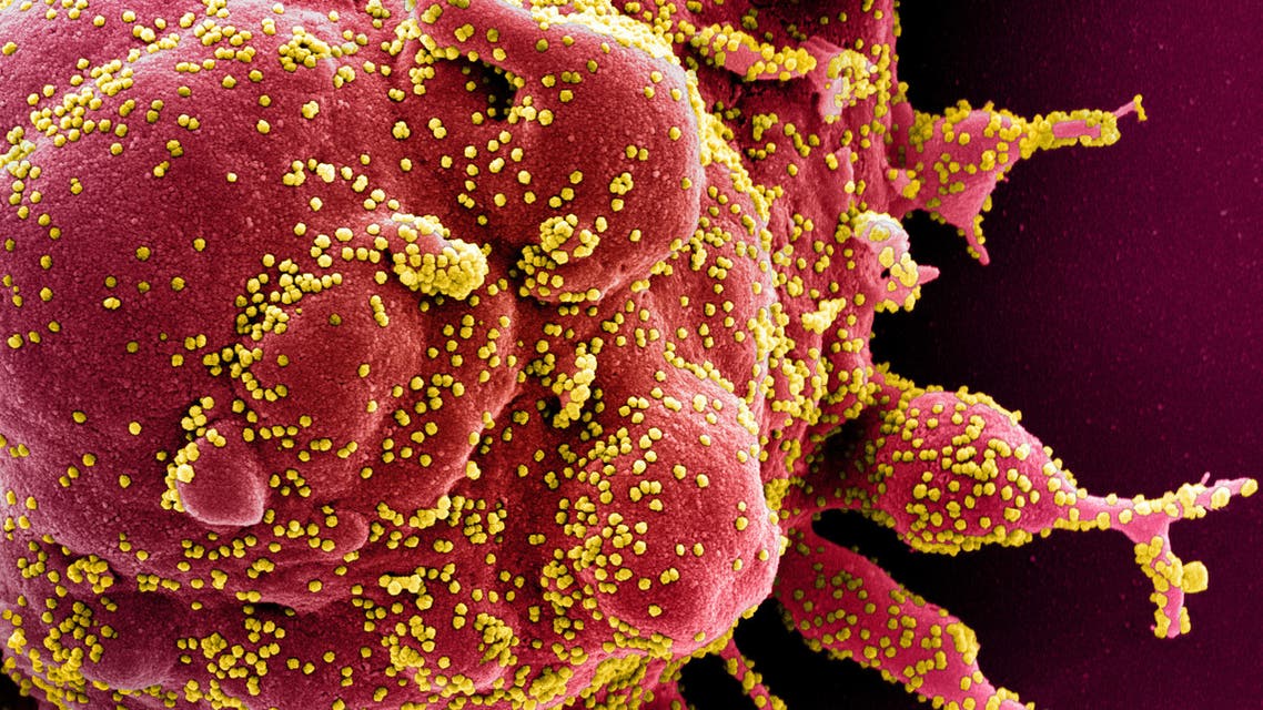 Colorized scanning electron micrograph of an apoptotic cell infected with SARS-COV-2 virus particles, also known as novel coronavirus, isolated from a patient sample. (Reuters)
