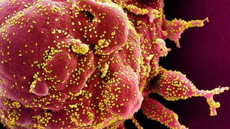 ‘Giant viruses’ many times bigger, more complex than coronavirus under study