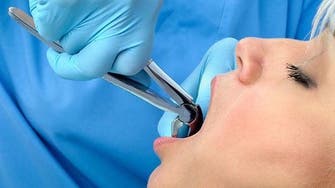 دندانپزشکان بریتانیایی 150 دندان سالم را به اشتباه کشیده‌اند