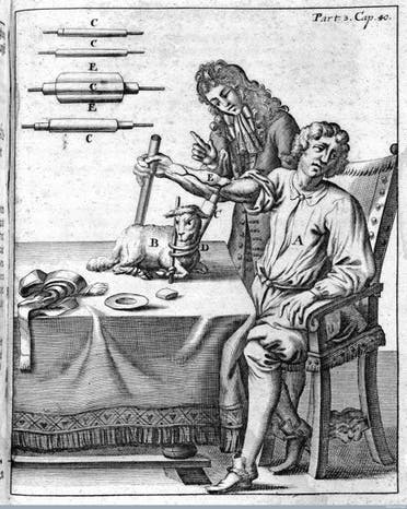 رسم تخيلي لأول عملية نقل دم لإنسان سنة 1667