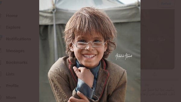 جديد النظارة الحديدية والطفل اليمني.. الصورة تفوز