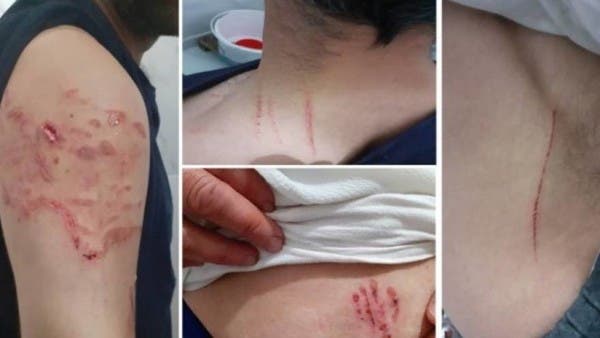 الشرطة التركية تعذب مواطناً كردياً بالكلاب البوليسية الشرسة