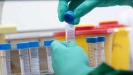 دانشمندان سعودی راهی برای جلوگیری از تکثیر ویروس کرونا یافتند