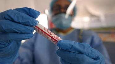 A laboratory worker handles a biological sample at a drive-through COVID-19 coronavirus testing centre in al-Khawaneej district of the gulf emirate of Dubai. (File photo: AFP)
