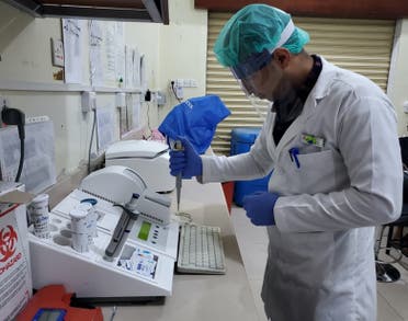 MSF Laboratory technician wearing a locally-produced face shield running blood tests in Taiz Houban project. (MSF)
