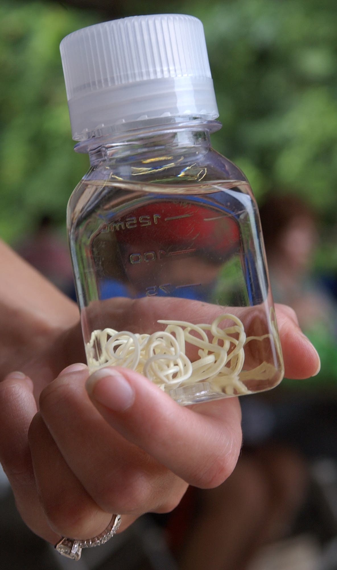 A jar containing Guinea worms shown in Atlanta in 2004. (File photo: AP)