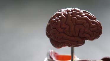 A diagram of the human brain. (File photo: Robina Weermeijer/Unsplash)