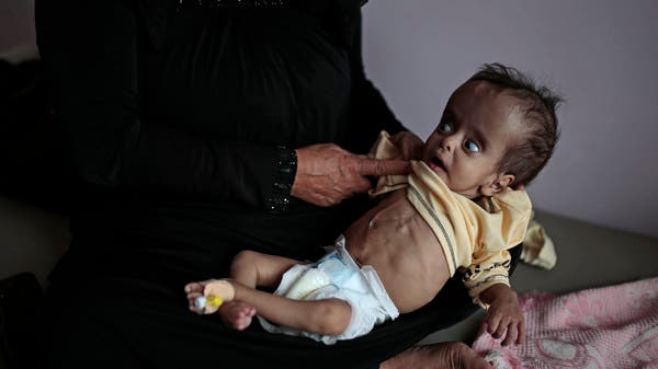صور مأساوية من اليمن.. الجوع يلاحق الأطفال