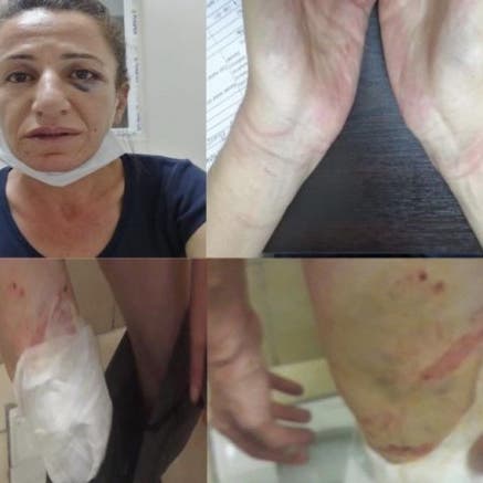 بالصور.. تعذيب سياسية معارضة يثير زوبعة في تركيا