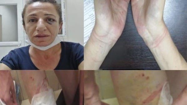 بالصور.. تعذيب سياسية معارضة يثير زوبعة في تركيا