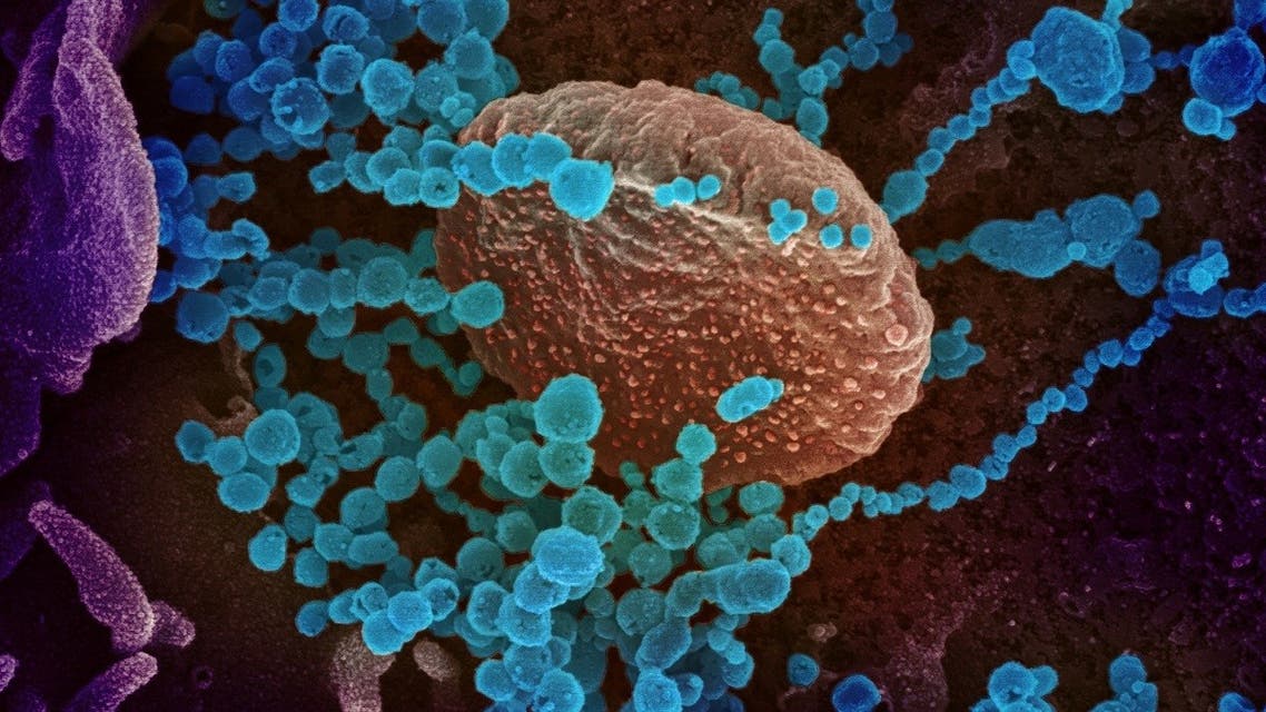 Scanning electron microscope image shows SARS-CoV-2, also known as novel coronavirus. (Reuters)